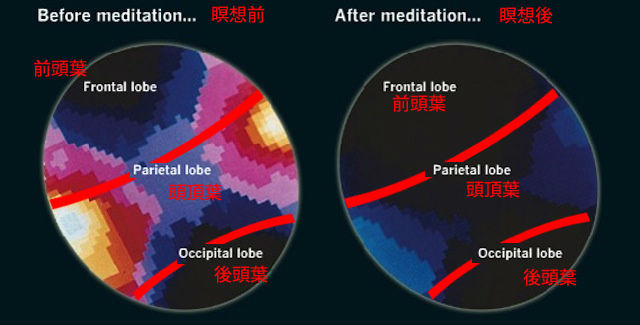 130904brain_meditate_03